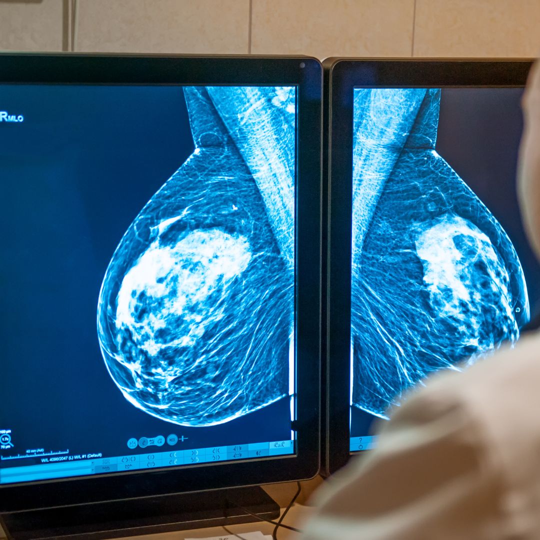 The Importance of a Breast Trained Radiologist Reading Your Mammogram Boutique Breast Imaging Blog